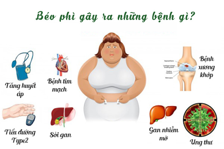 Béo phì tiềm ẩn nhiều bệnh nguy hiểm có thể bạn chưa biết